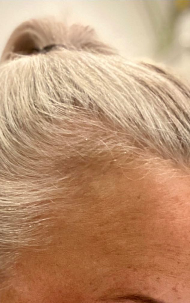 light hair regained color and regrowth