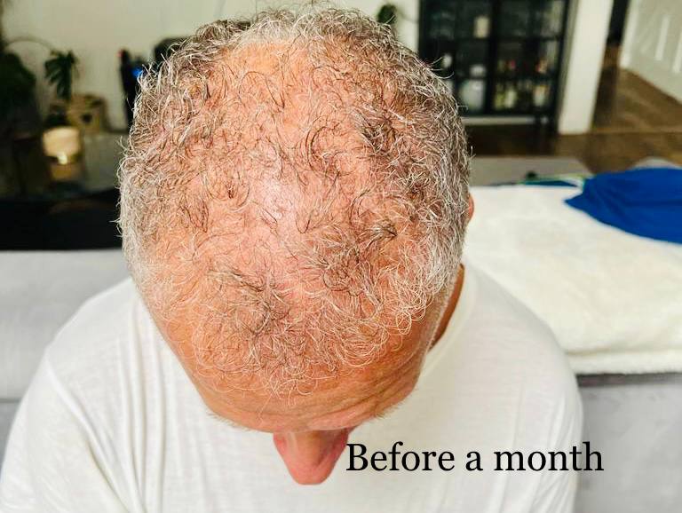lost hair head