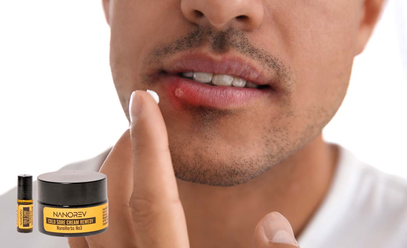 cold sore solutions